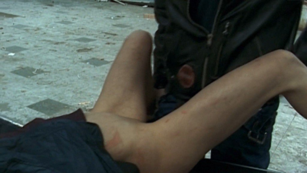 Раффаэла Андерсон, Карен Ланком обнажённые 4